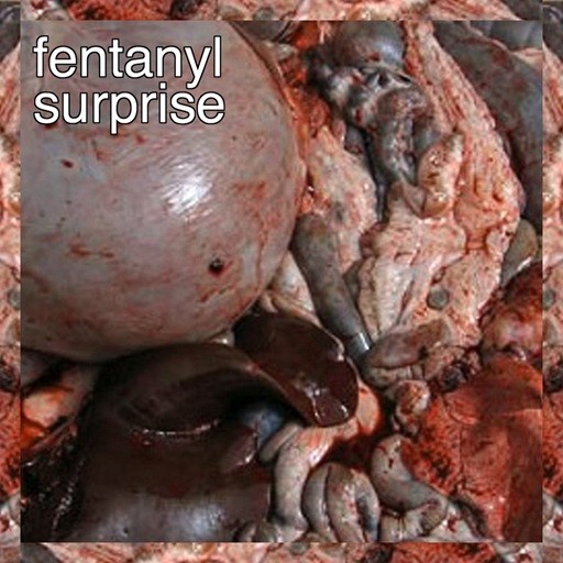 Fentanyl Surprise