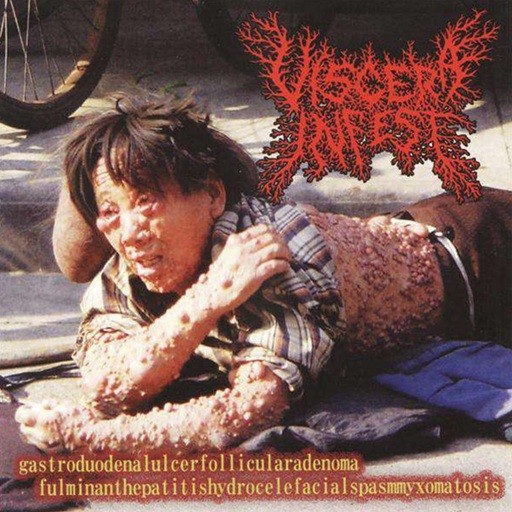 Viscera Infest / Paracoccidioidomicosisproctitissarcomucosis