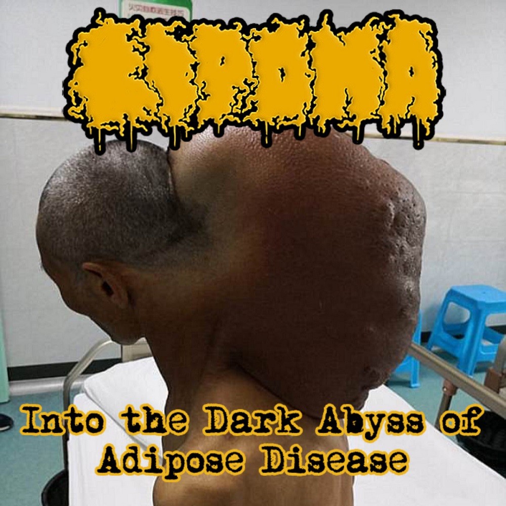 Lipoma - Into the Dark Abyss of Adipose Disease (2021) Cover