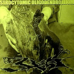 Astrocytomic Oligodendrollioma