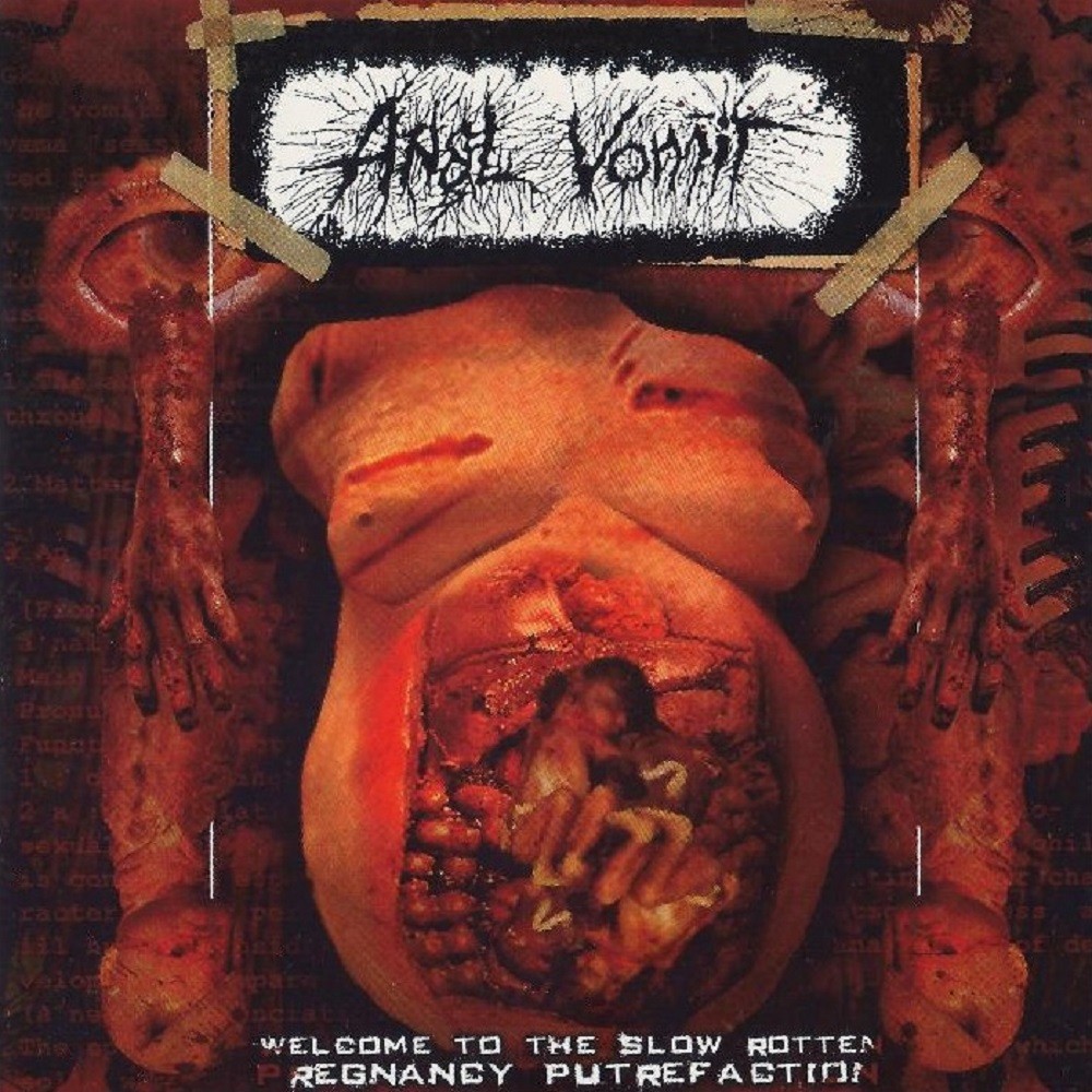 Anal Vomit - Welcome to the Slow Rotten Pregnancy Putrefaction (2010) Cover