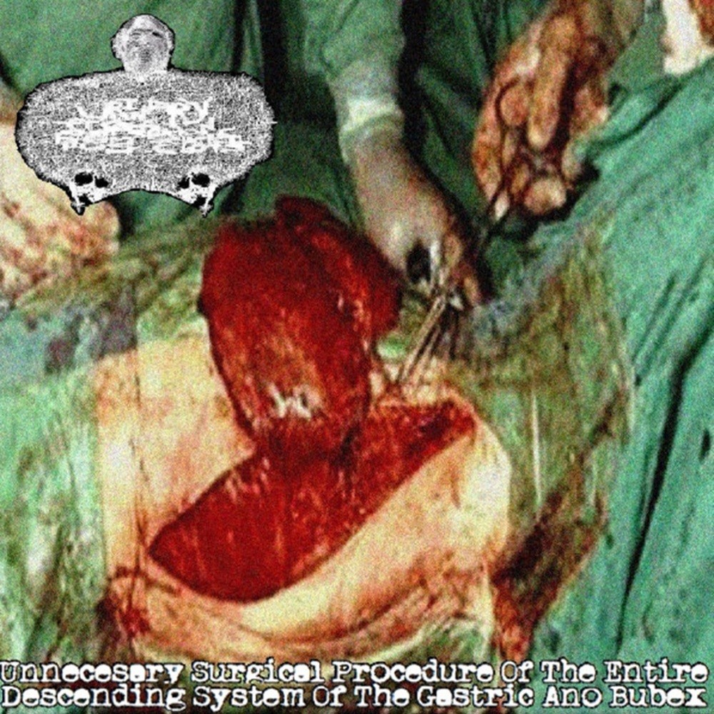 Urinary Tract Infection From Severe Pus Clots - Unnecesary Surgical Procedure of the Entire Descending System of the Gastric Ano Bubex (2010) Cover
