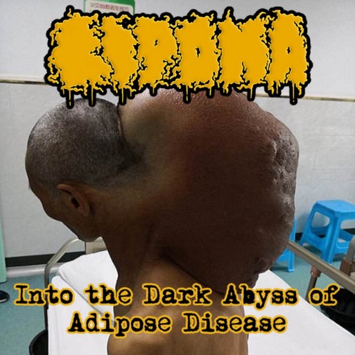Into the Dark Abyss of Adipose Disease