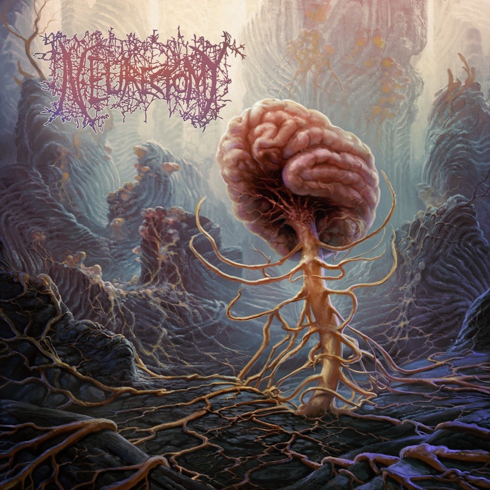 Neurectomy - Overwrought (2023) Cover