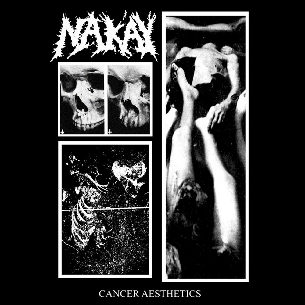 Nak'ay - Cancer Aesthetics (2019) Cover