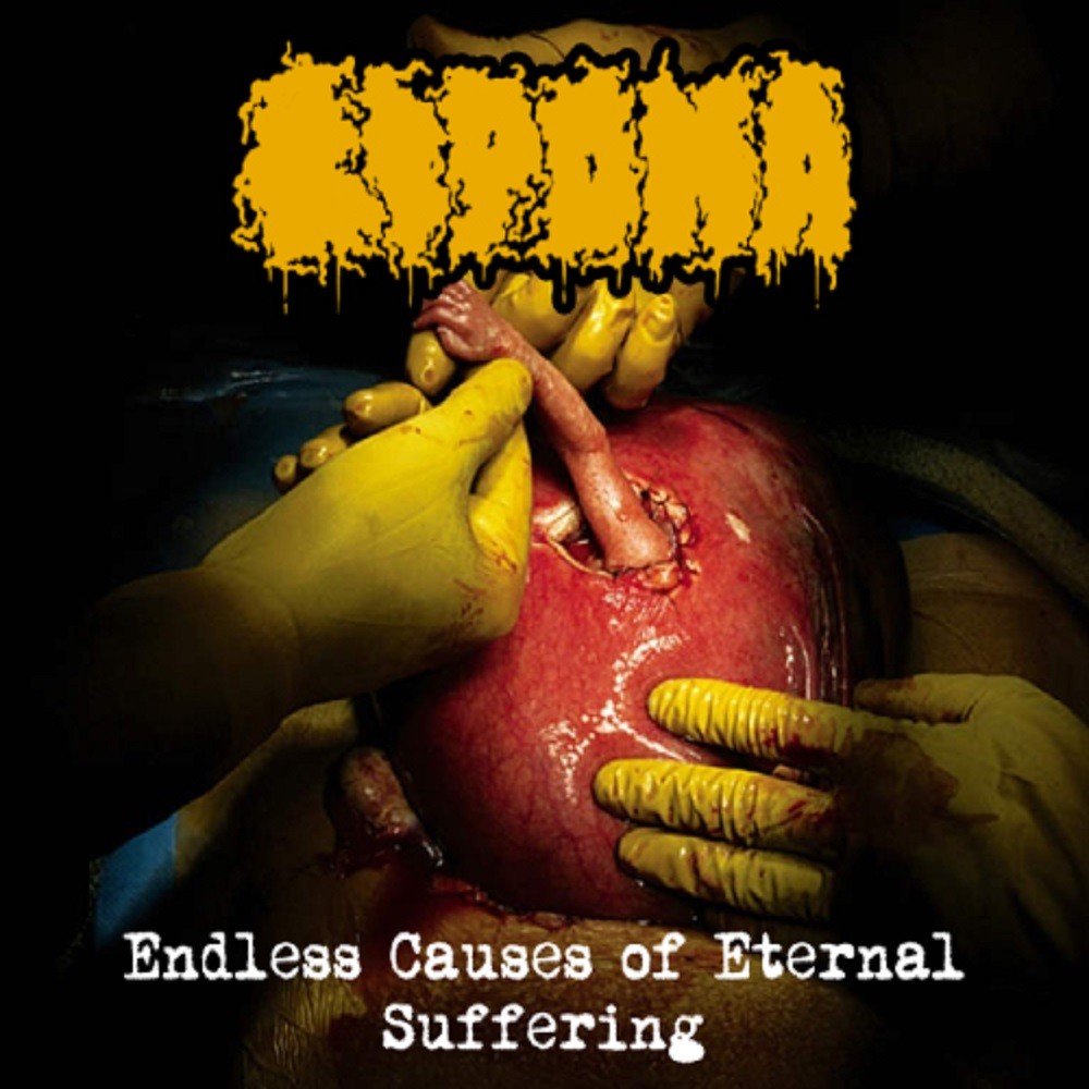 Lipoma - Endless Causes of Eternal Suffering (2022) Cover
