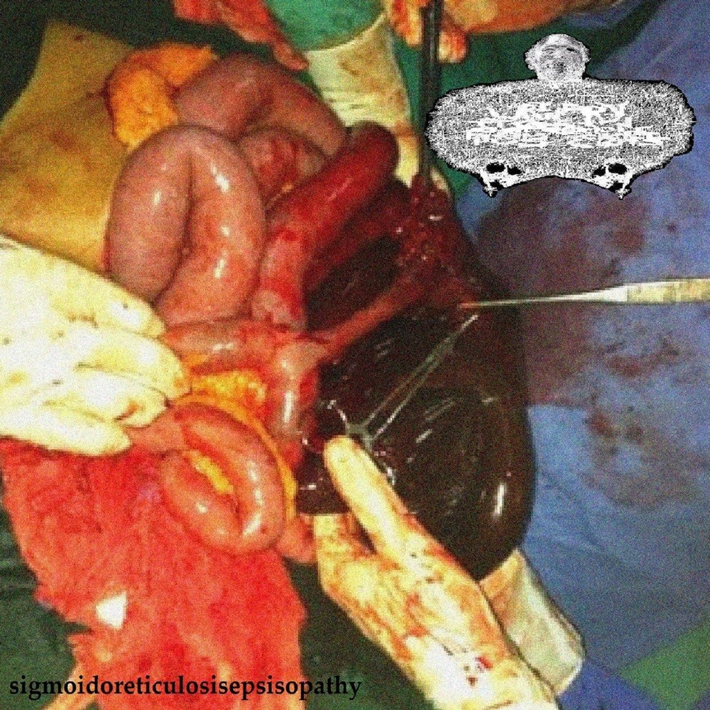 Urinary Tract Infection From Severe Pus Clots - Sigmoidoreticulosisepsisopathy (2025) Cover