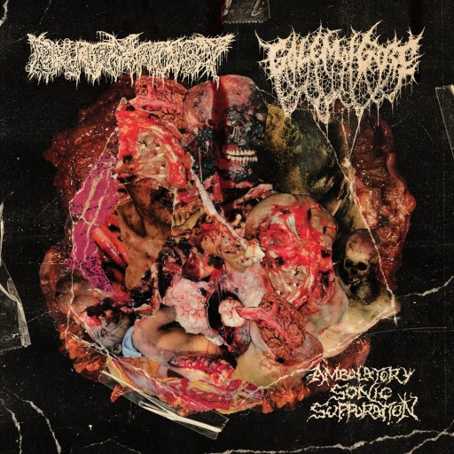 Ambulatory Sonic Suppuration