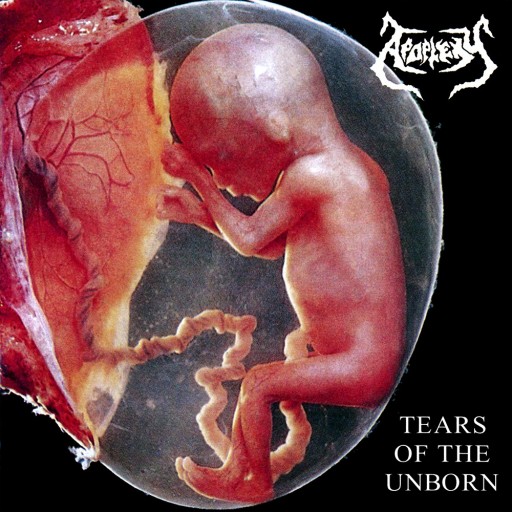 Tears of the Unborn