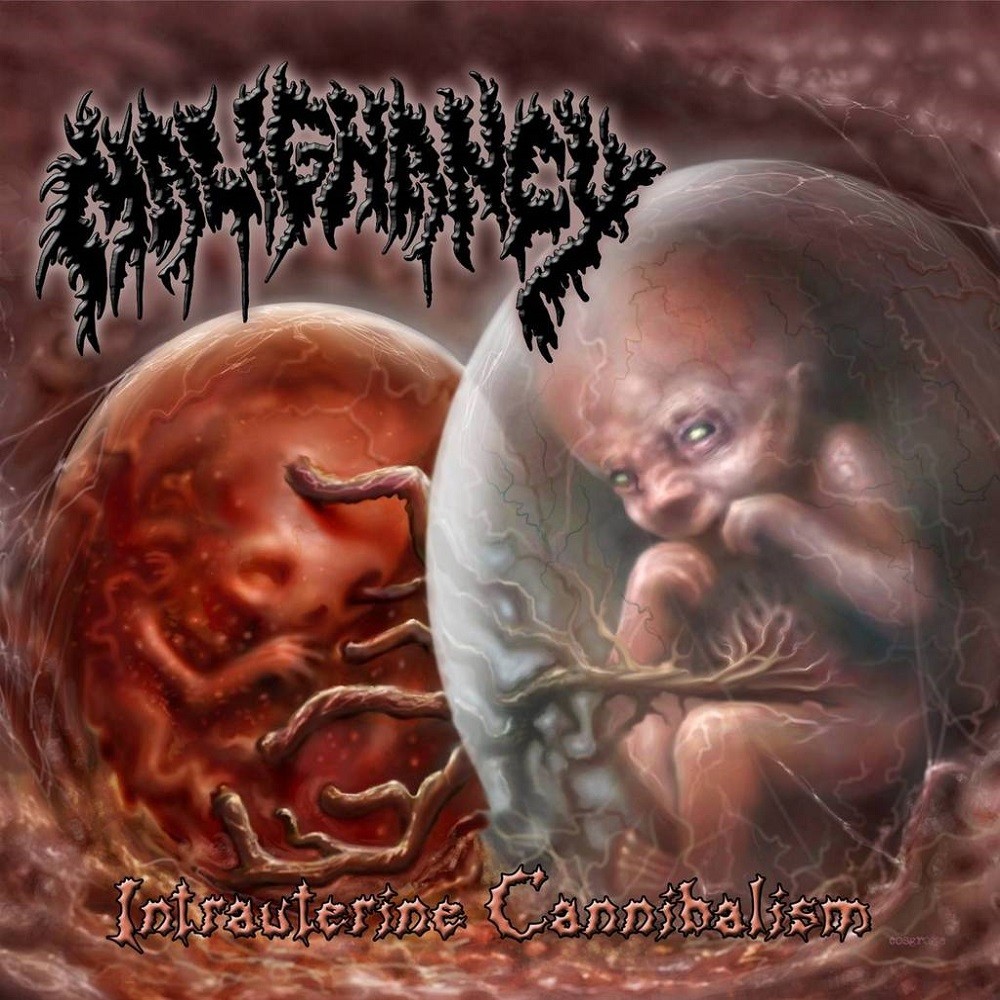 Malignancy - Intrauterine Cannibalism (2019) Cover