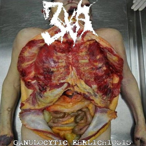 Ganulocytic Ehrlichiosis