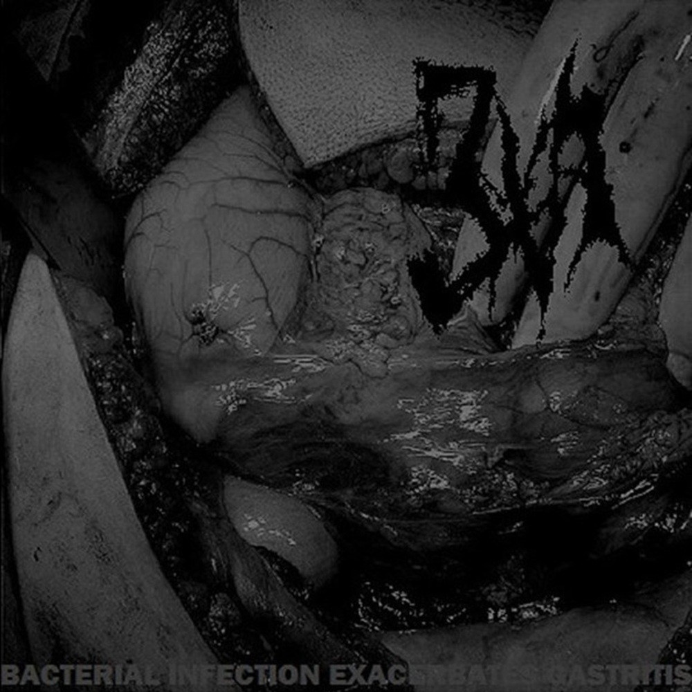 3XA - Bacterial Infection Exacerbates Gastritis (2015) Cover