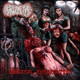 Surgical Excoriation