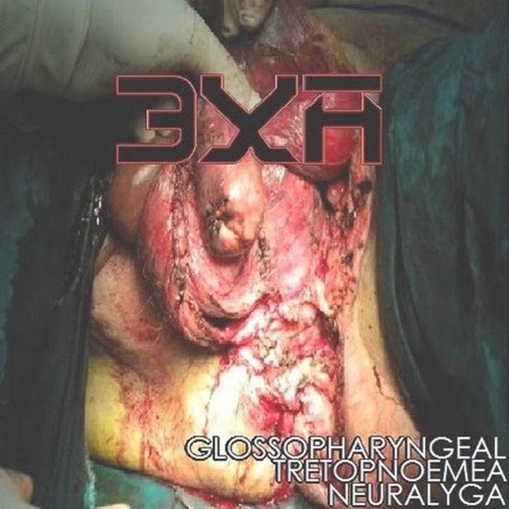 3XA - Glossopharyngeal Tretopnoemea Neuralyga (2014) Cover