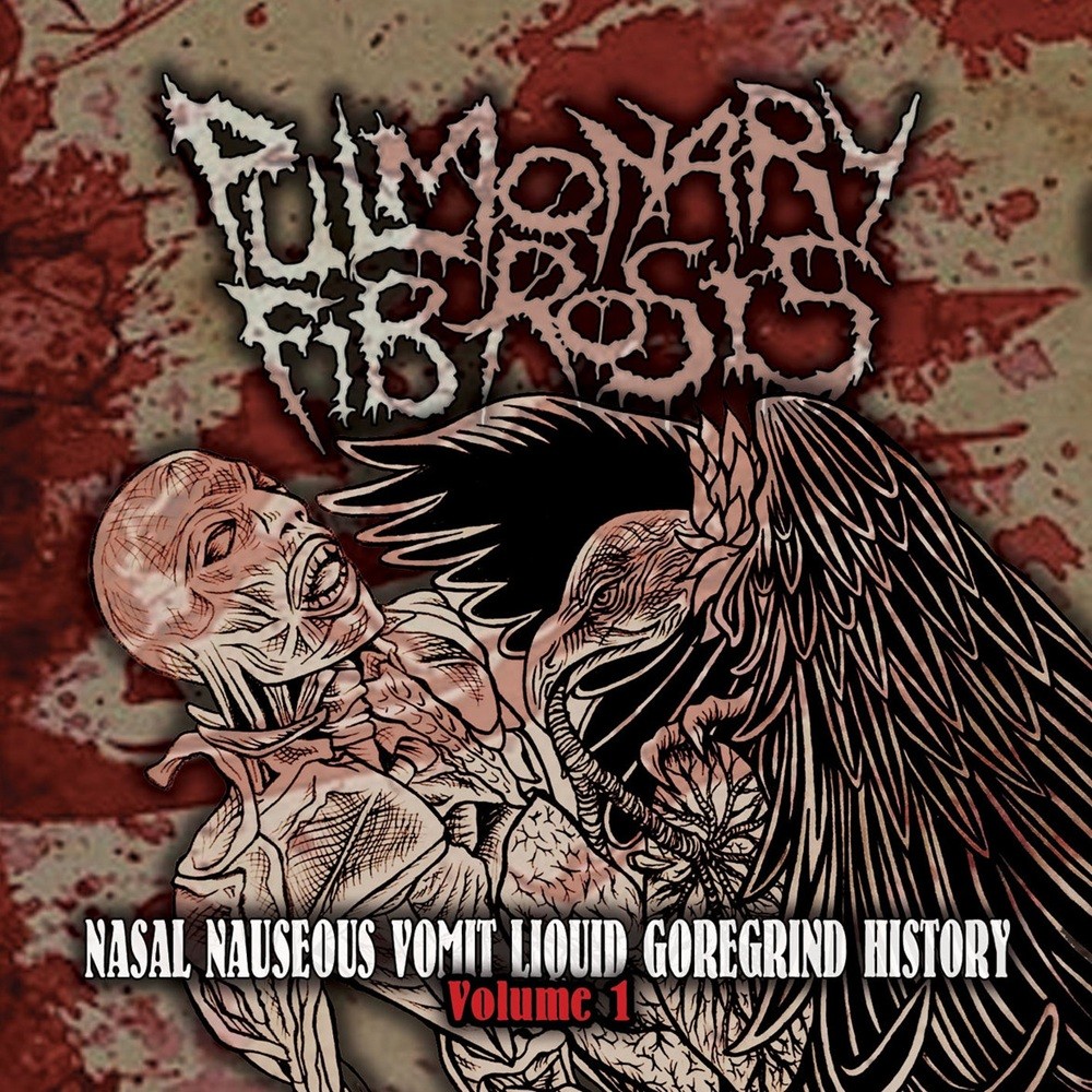 Pulmonary Fibrosis - Nasal Nauseous Vomit Liquid Goregrind History Volume 1 (2021) Cover