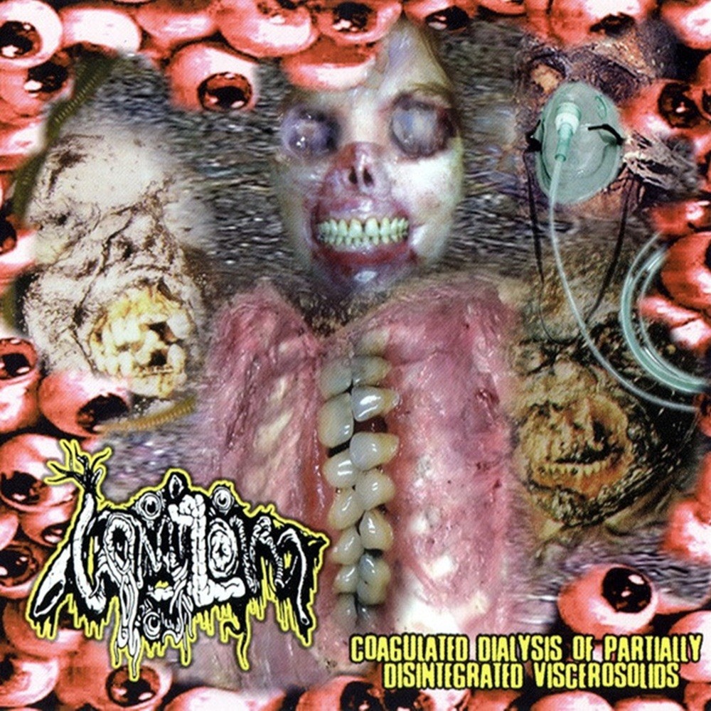Vomitoma - Coagulated Dialysis of Partially Disintegrated Viscerosolids (2011) Cover
