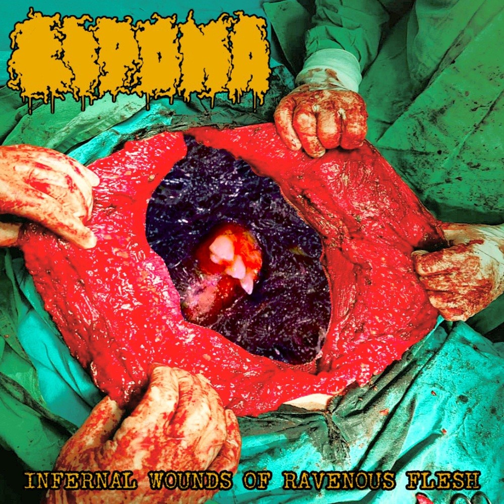 Lipoma - Infernal Wounds of Ravenous Flesh (2026) Cover