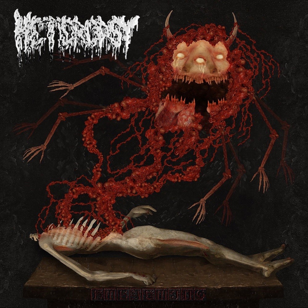 Heteropsy - Embalming