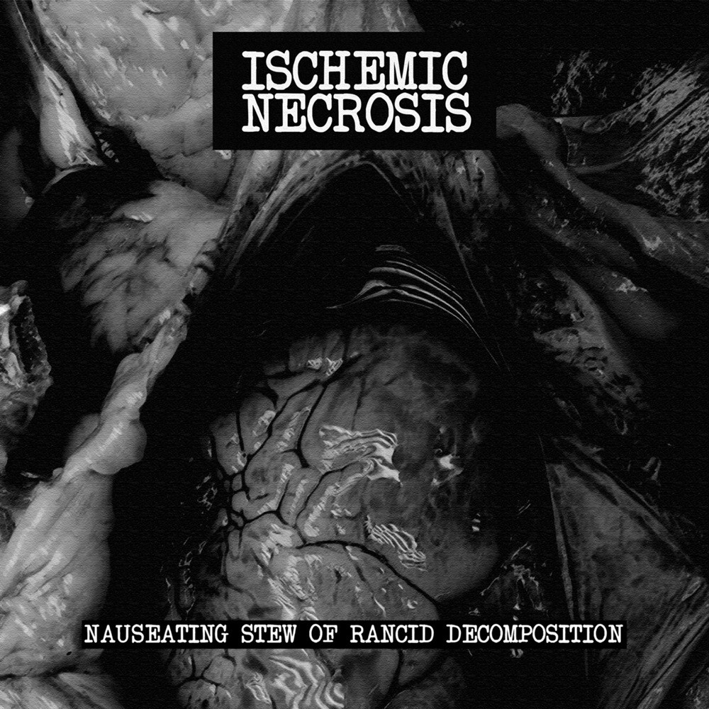 Ischemic Necrosis - Nauseating Stew of Rancid Decomposition (2021) Cover