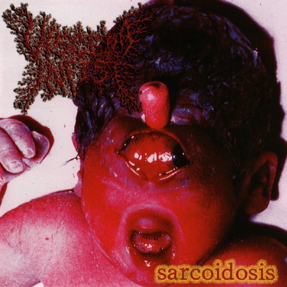 Viscera Infest - Sarcoidosis (2007) Cover