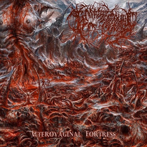 Uterovaginal Fortress