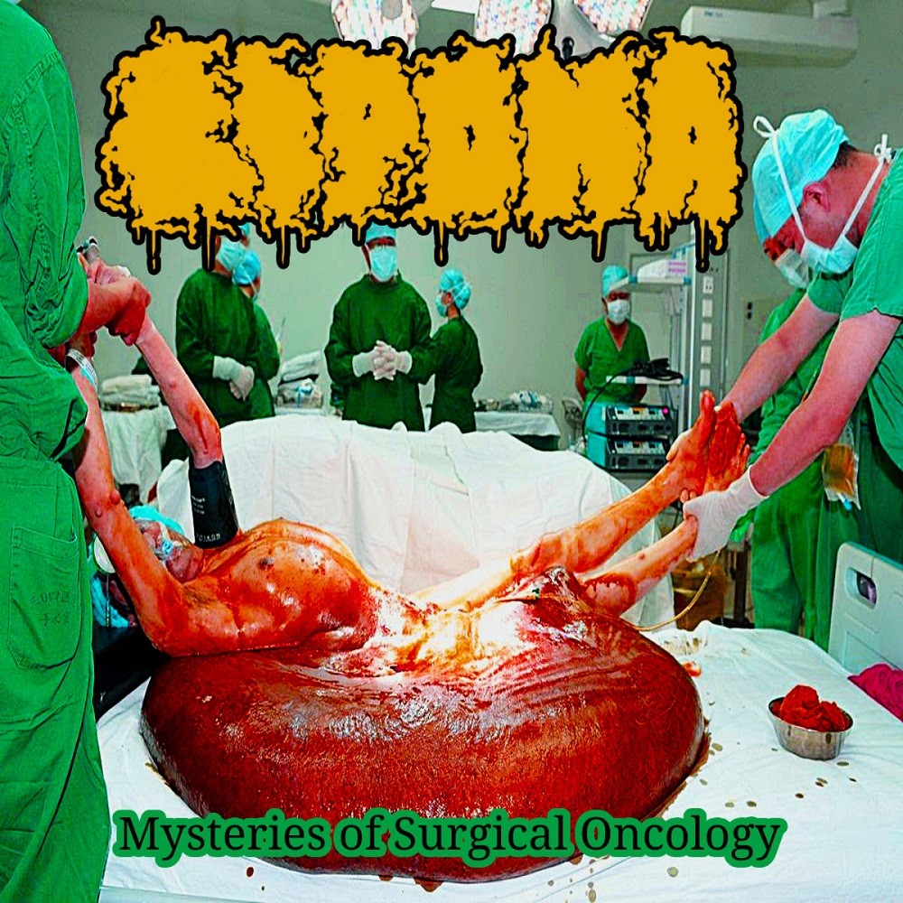 Lipoma - Mysteries of Surgical Oncology (2022) Cover