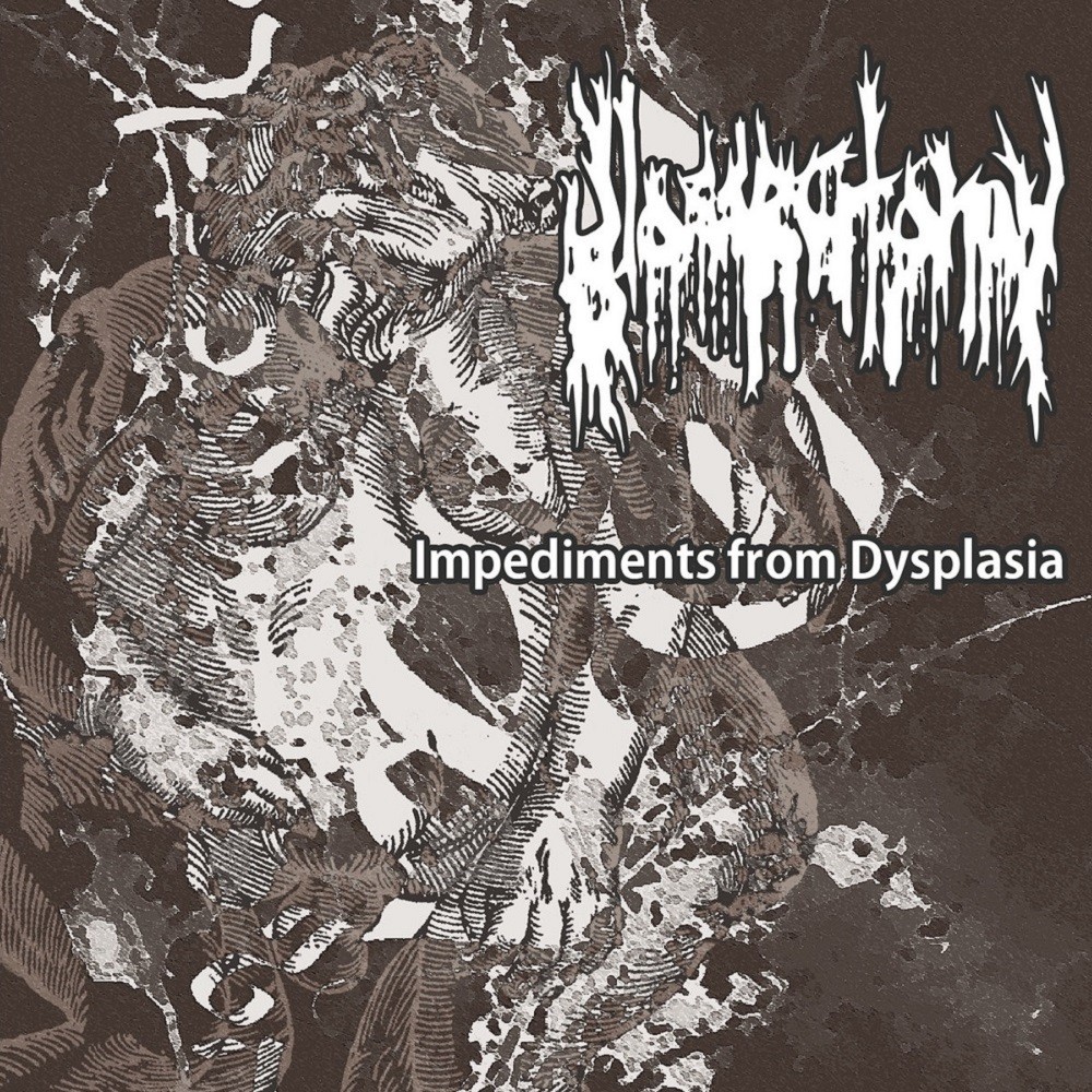 Glossectomy - Impediments From Dysplasia (2014) Cover