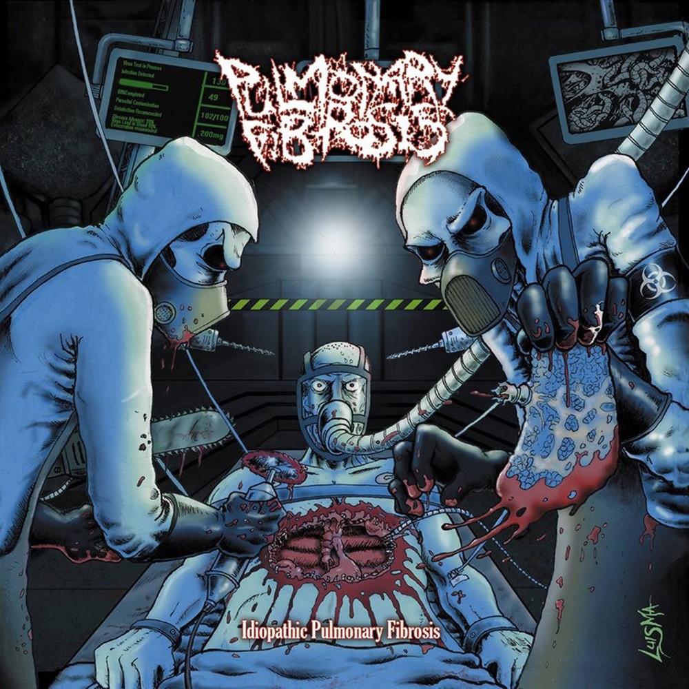 Pulmonary Fibrosis - Idiopathic Pulmonary Fibrosis (2016) Cover
