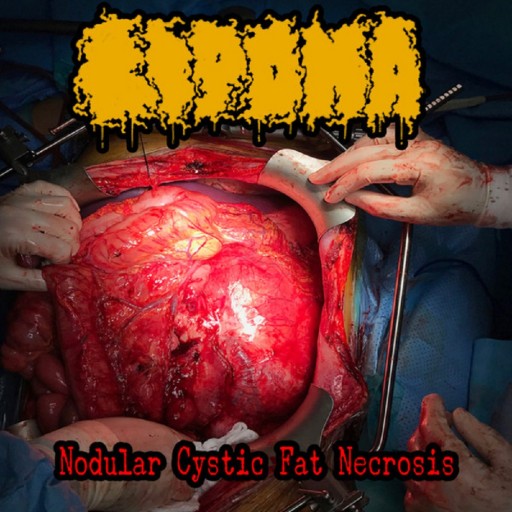 Nodular Cystic Fat Necrosis