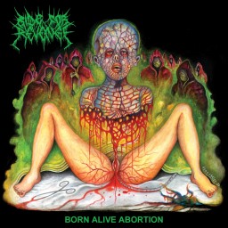 Born Alive Abortion